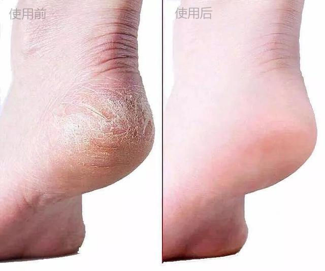 身体乳那手和脚擦